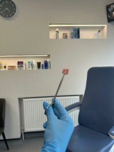 nail that has been removed